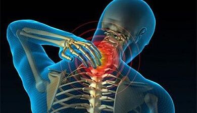 Symptoms of cervical column osteochondrosis